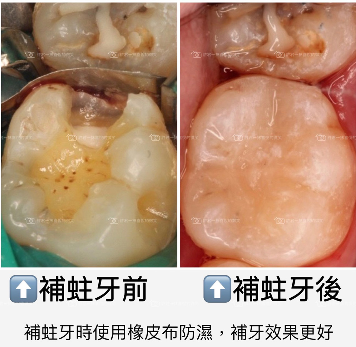 什麼?牙齒好像要斷了!?