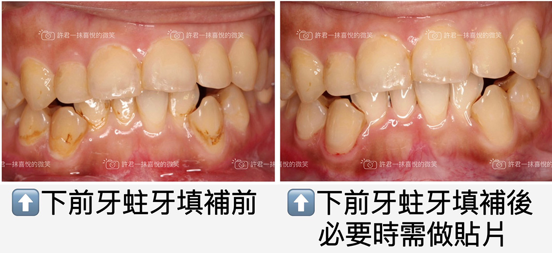 什麼?牙齒好像要斷了!?