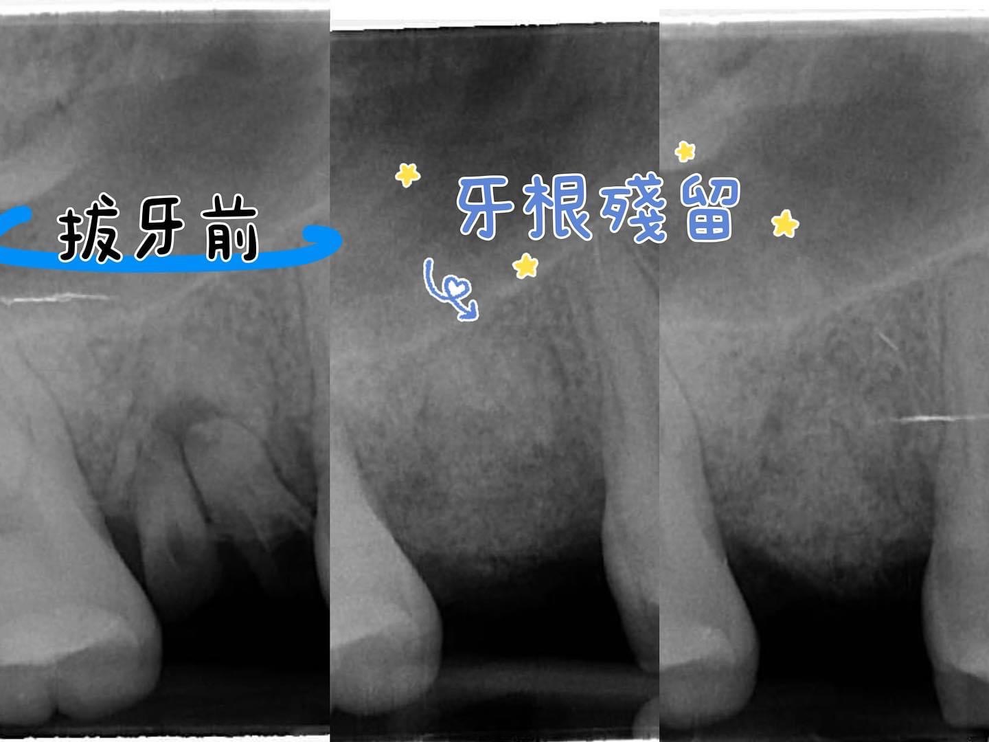 穩紮穩打一步步做