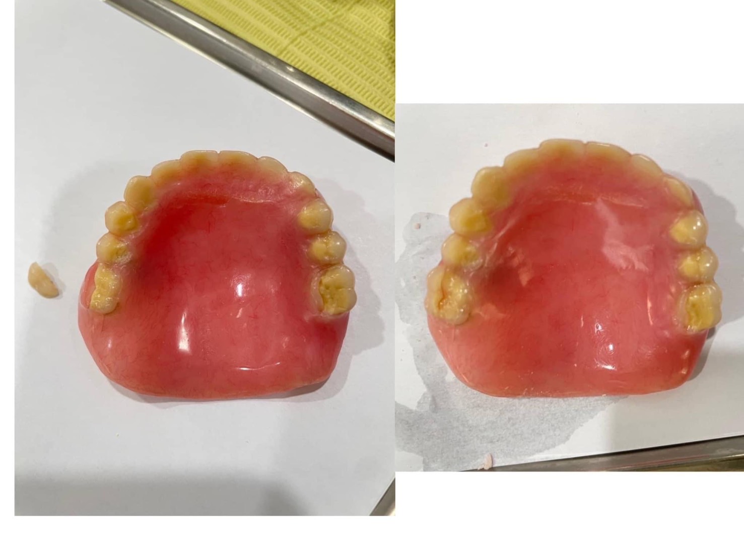 附連體有分兩種