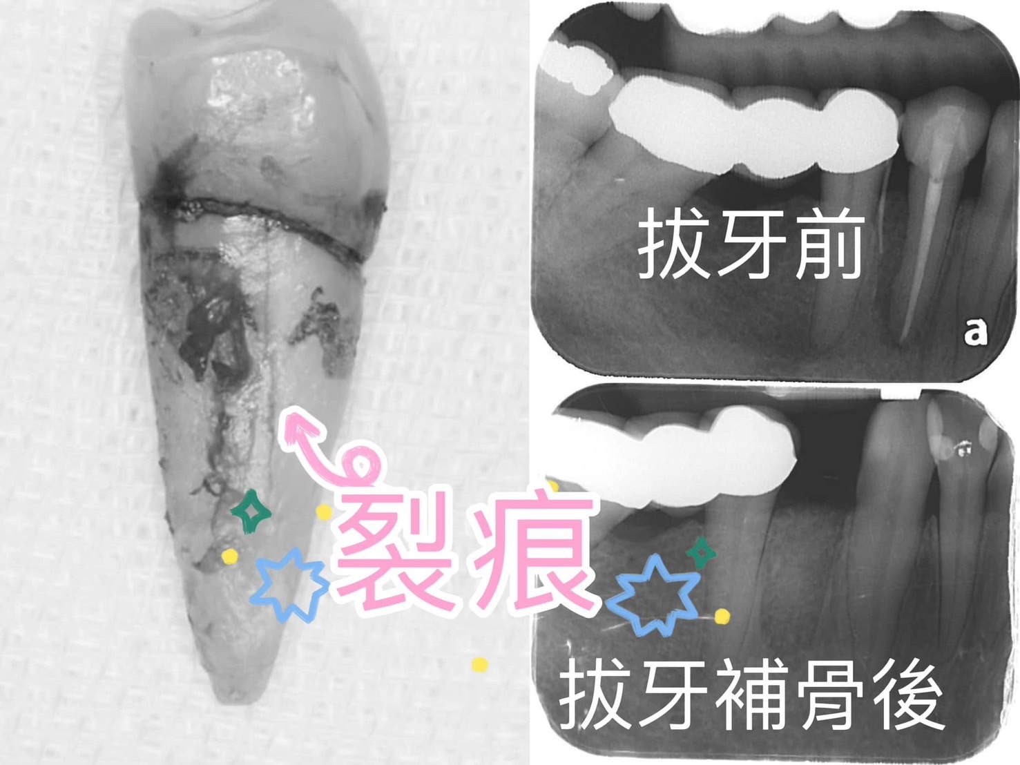 穩紮穩打一步步做
