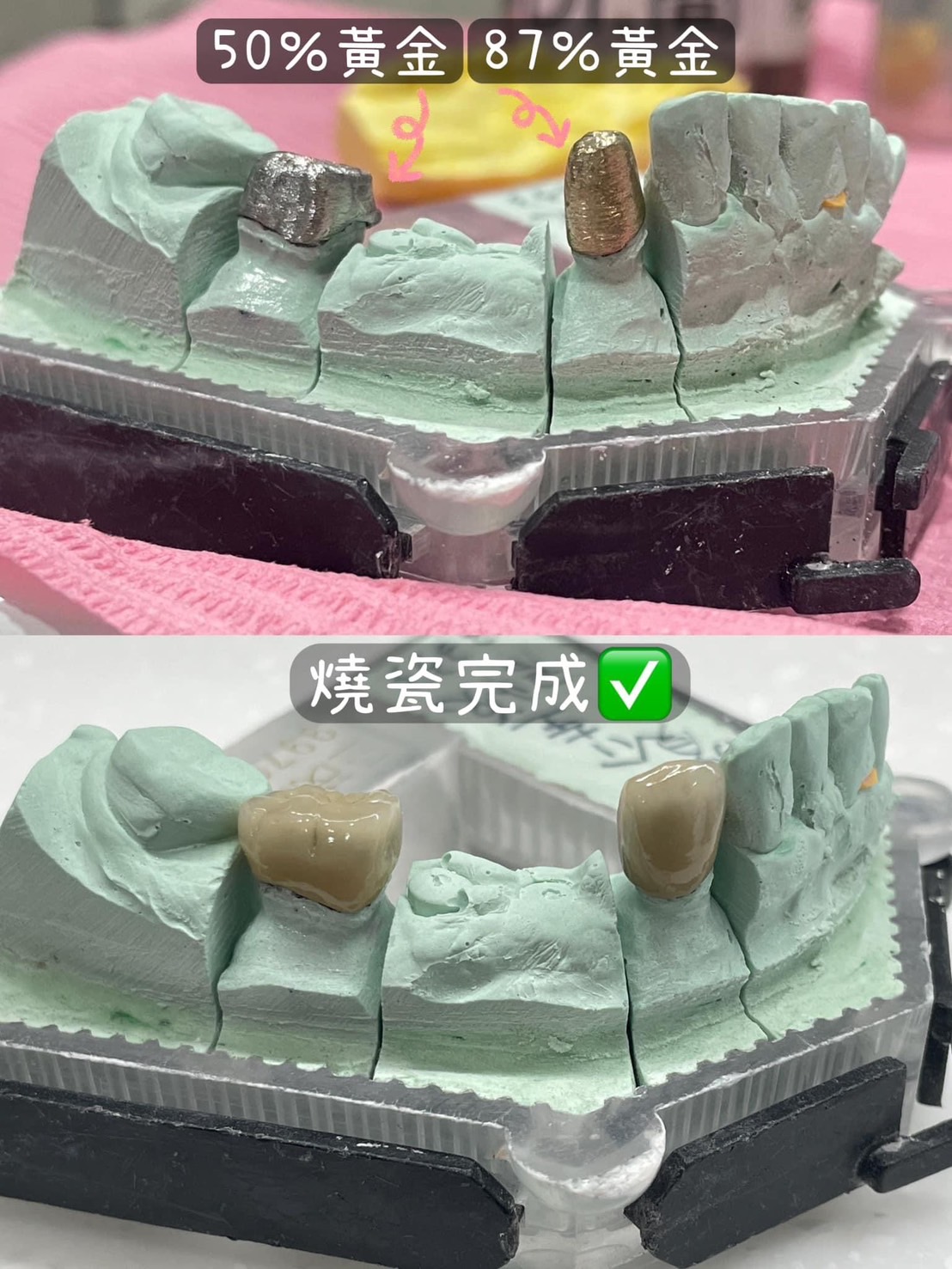 你準備好人生旅途中的層層關卡嗎?