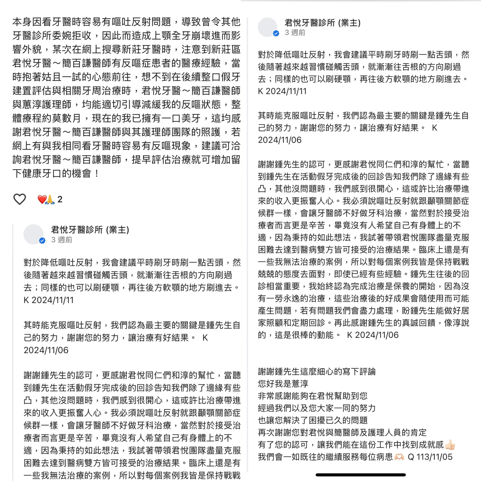 製作活動假牙方式百百種