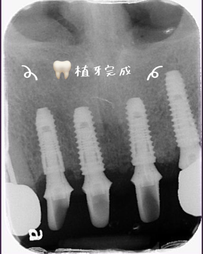 技術是關鍵要素