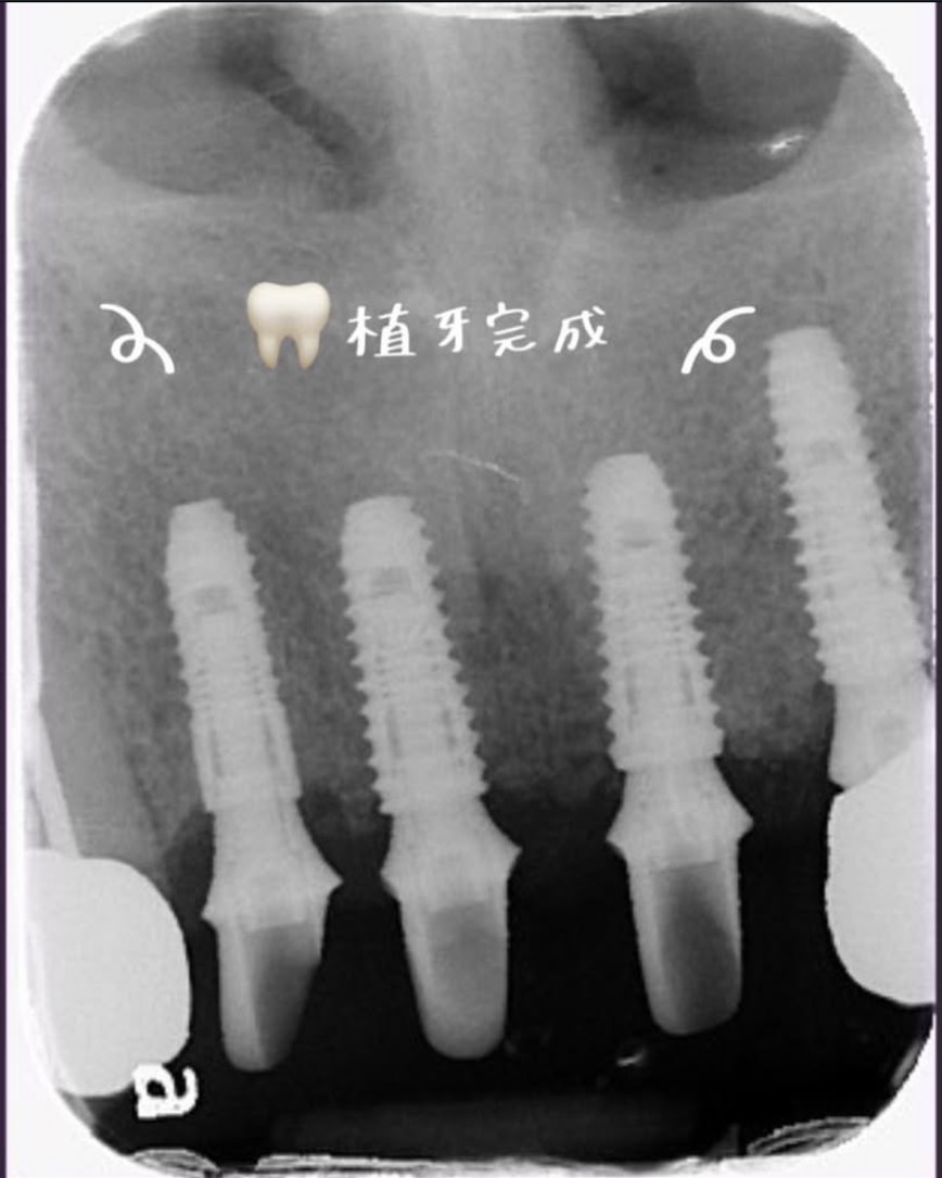 意外診療案例
