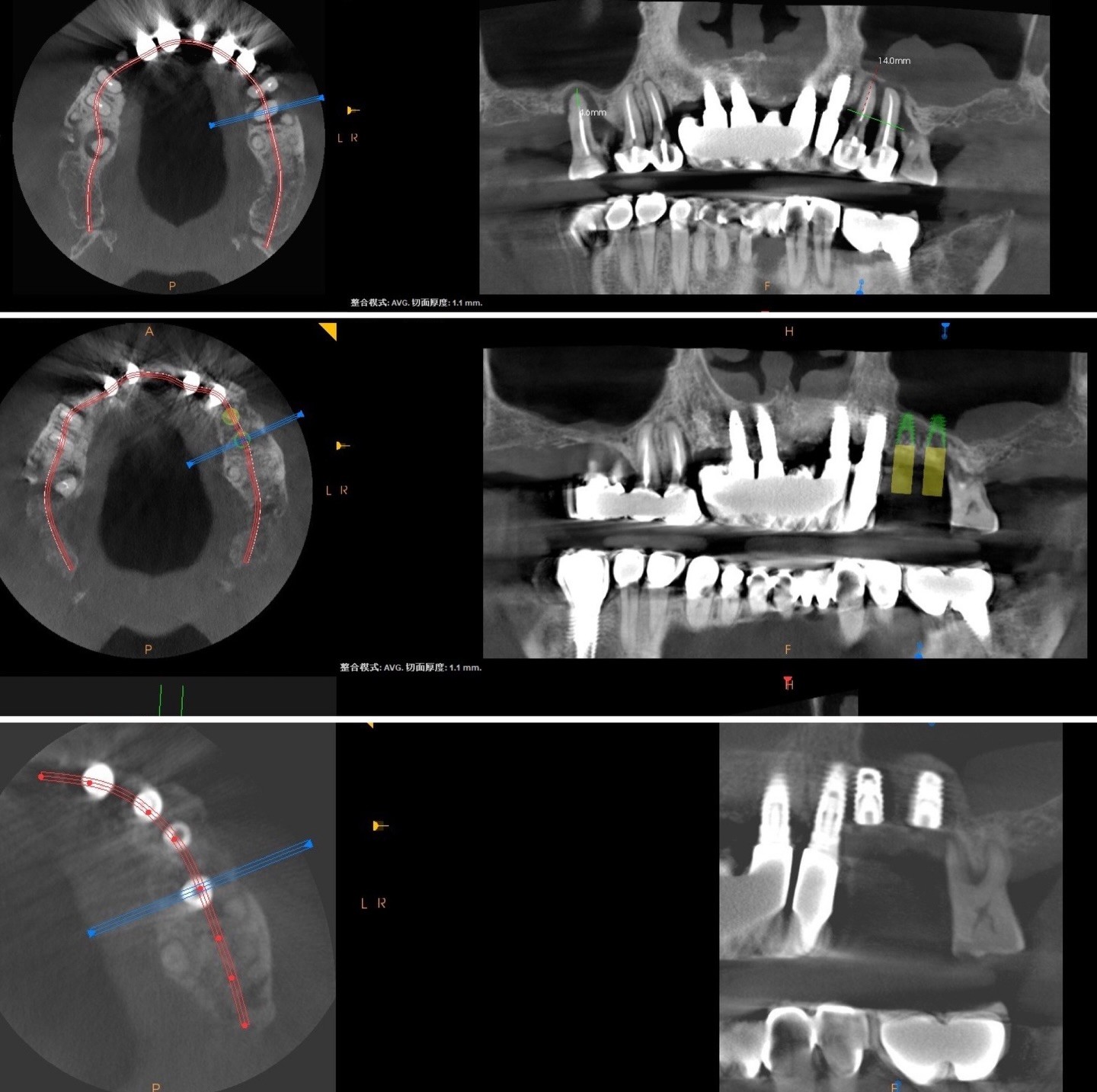 messageImage_1767162294988_0