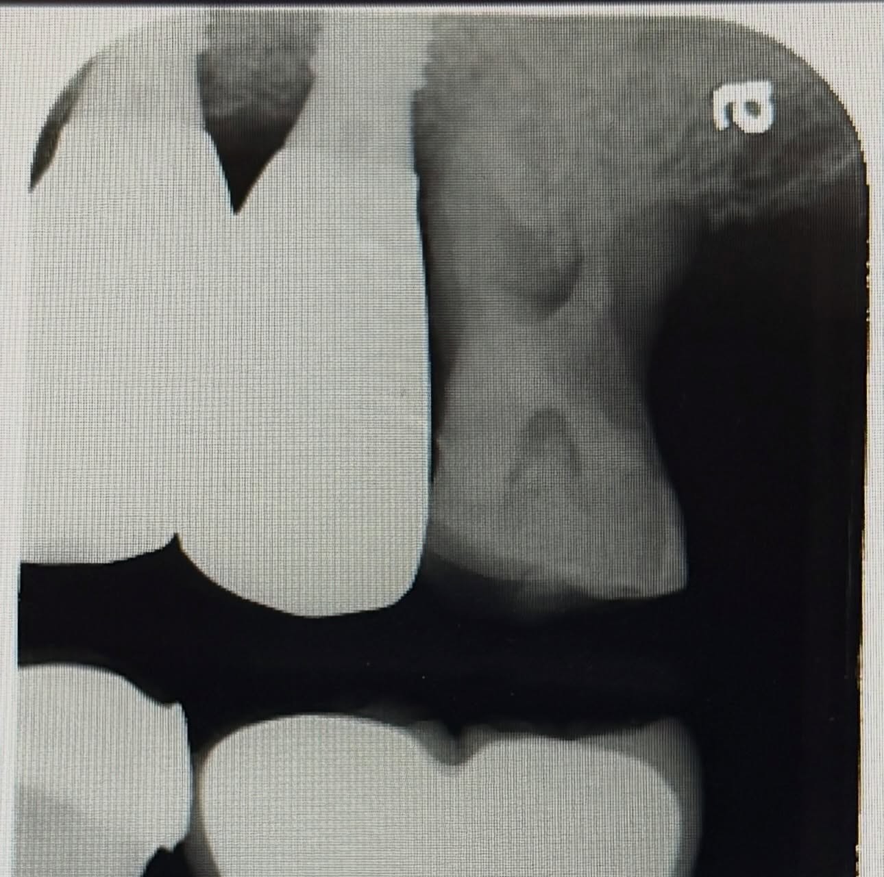 messageImage_1767162331104_0