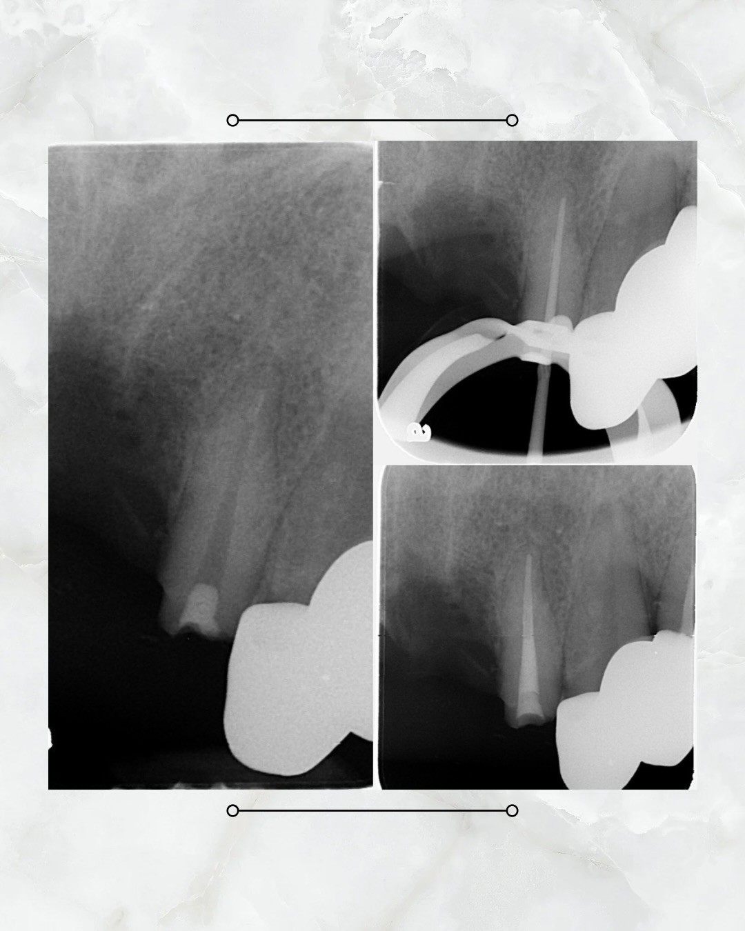 messageImage_1774248952810_0