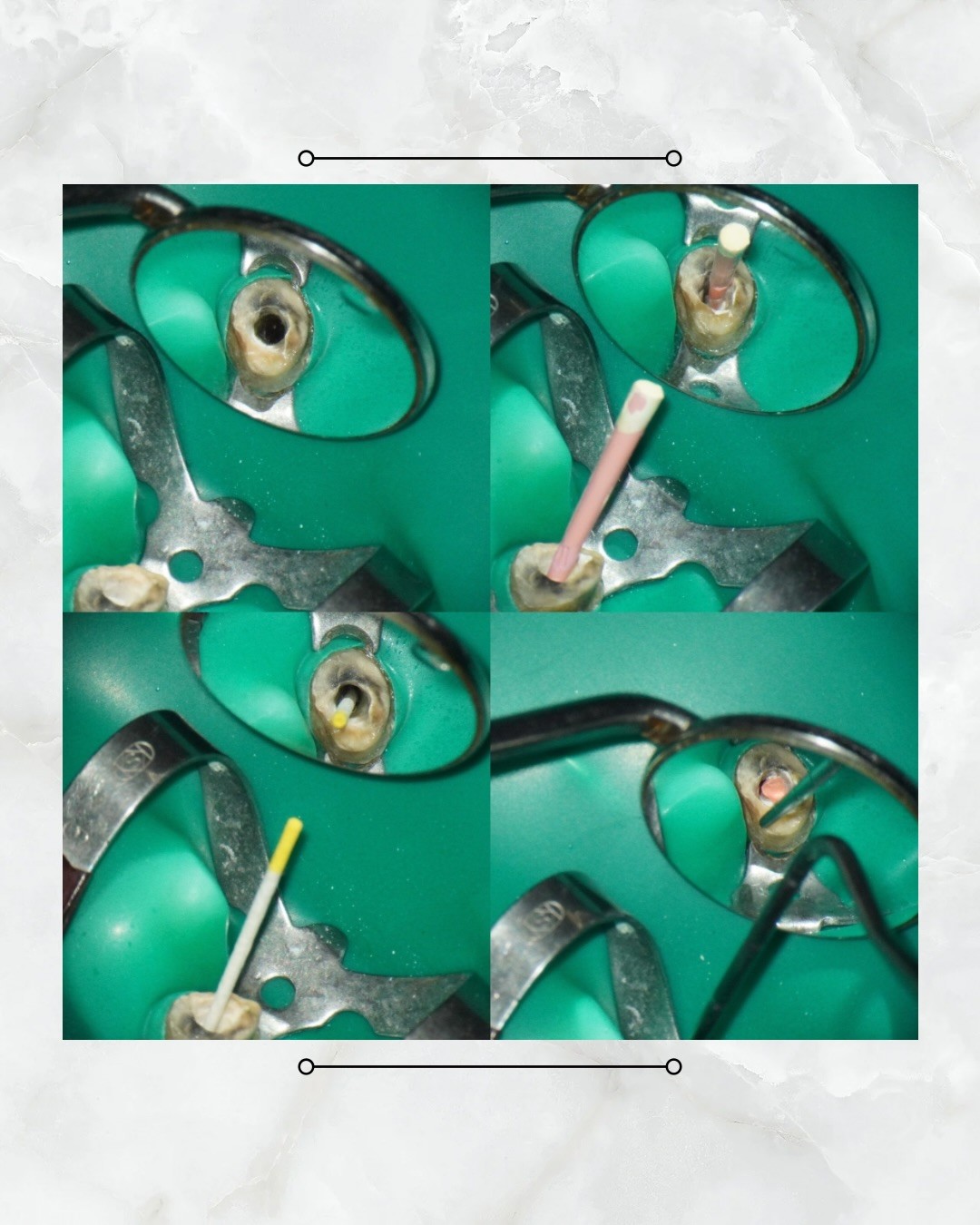 messageImage_1774248960448_0