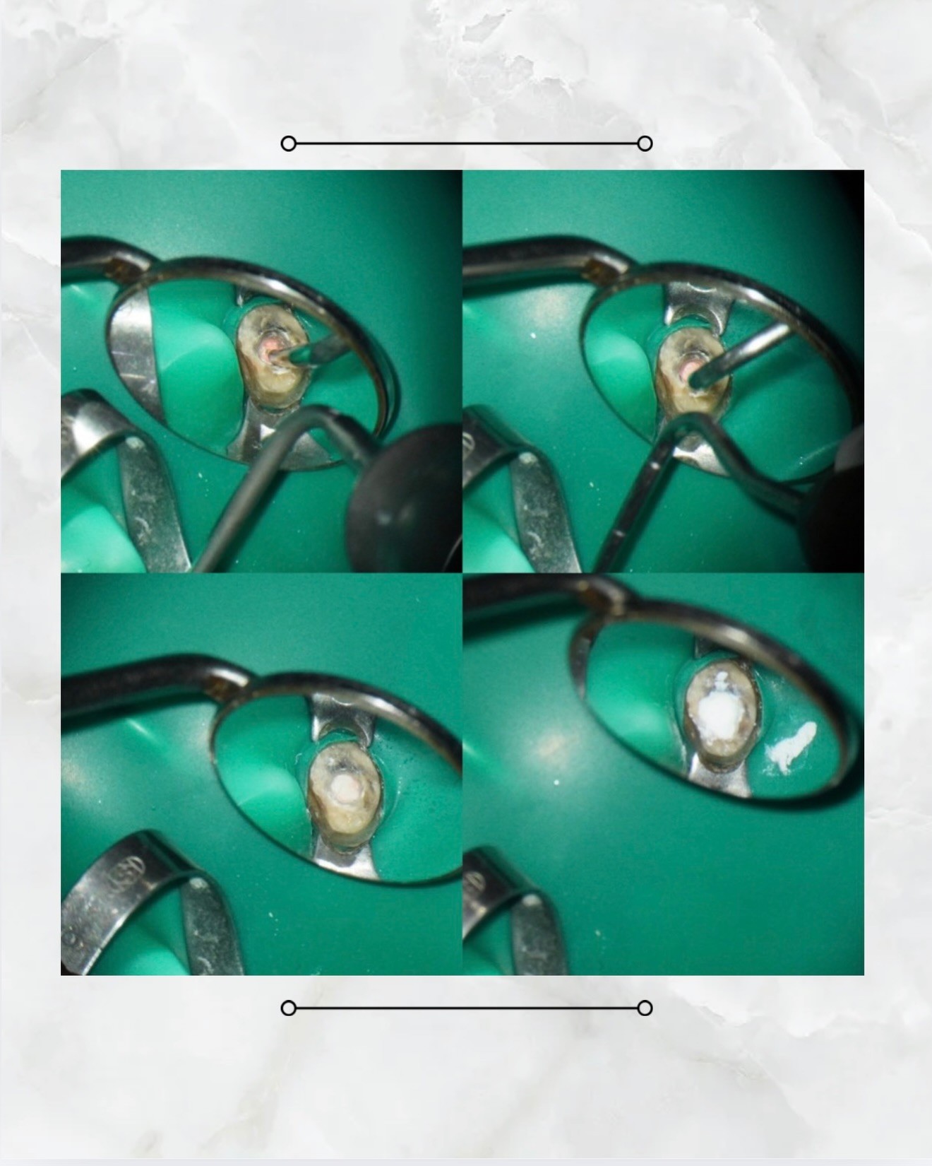 messageImage_1774248966765_0