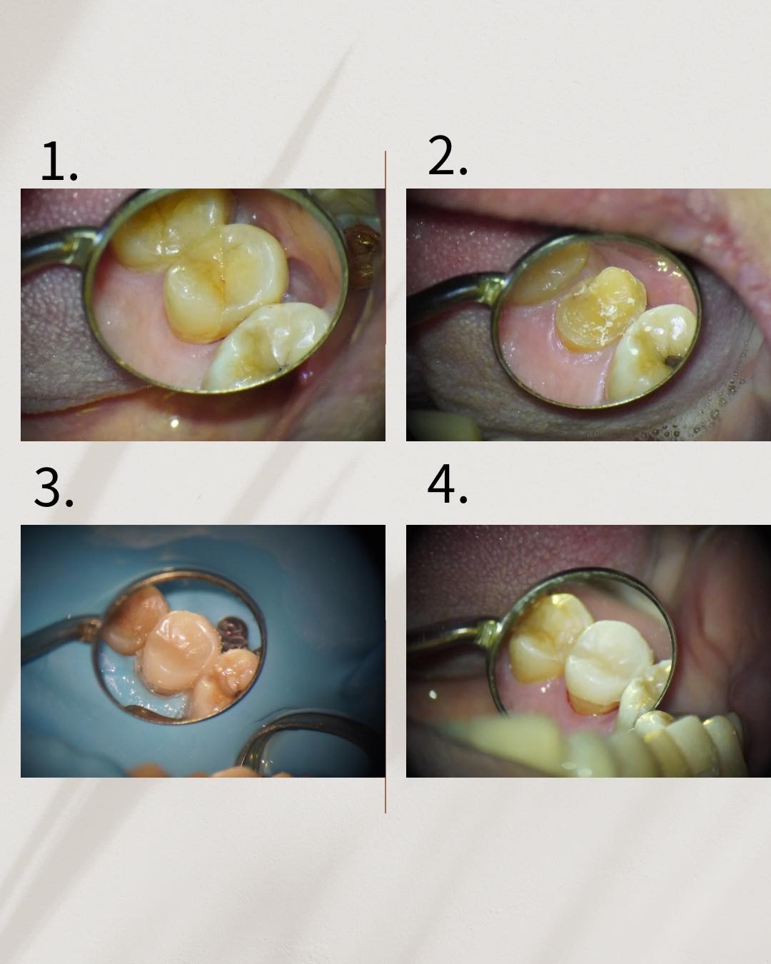 messageImage_1774257385764