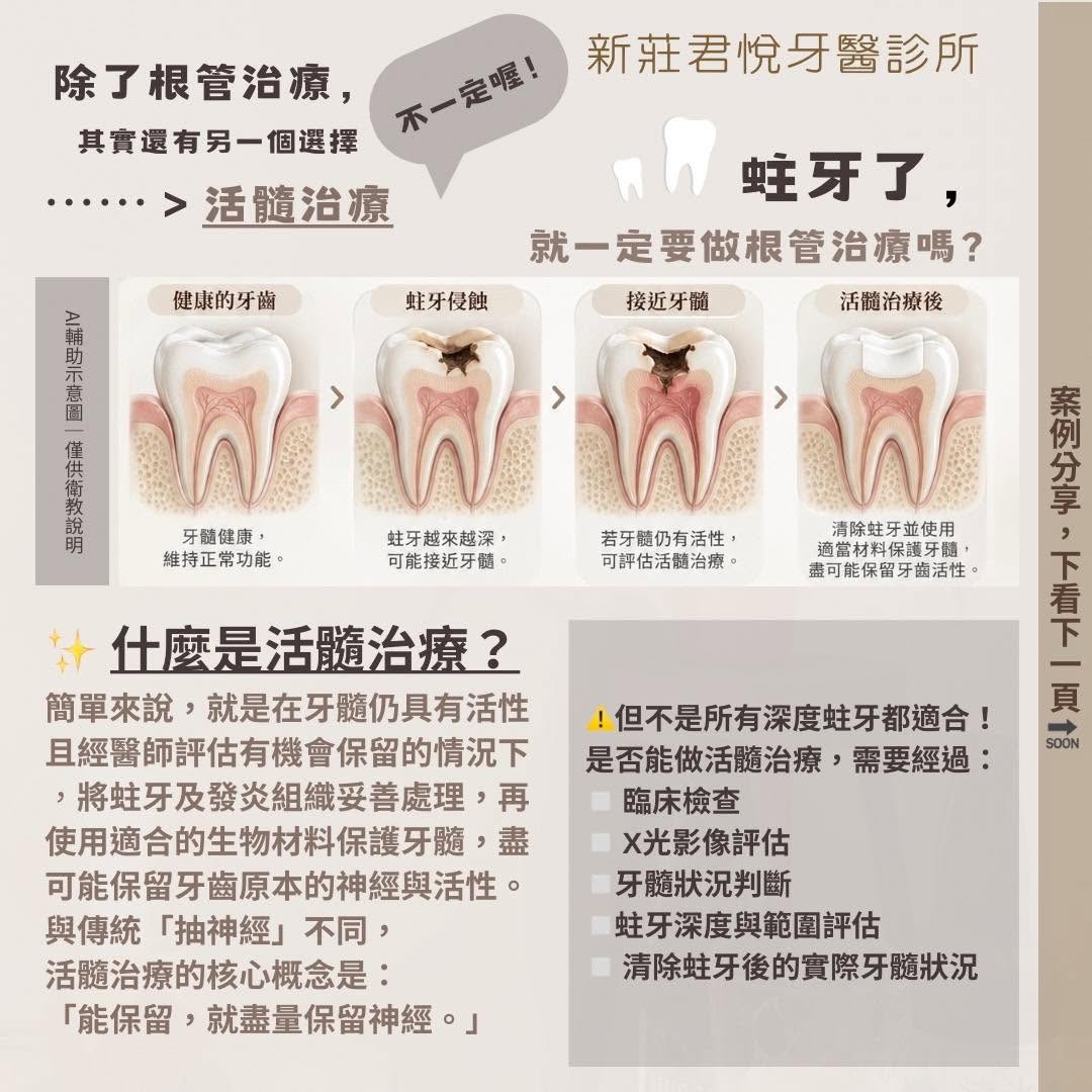 蛀牙了，就一定要做根管治療嗎？